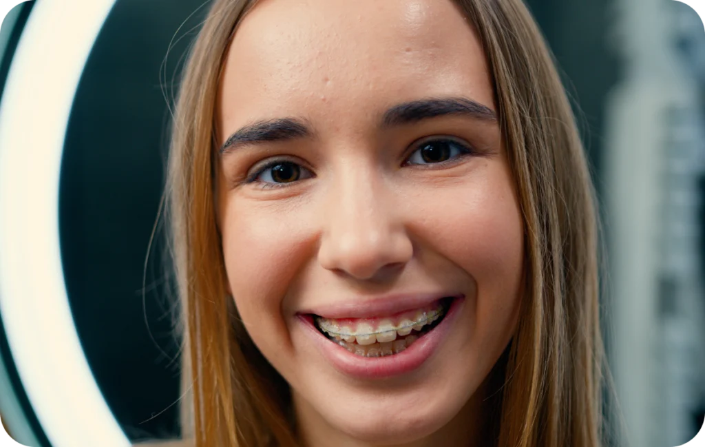 appareils dentaires mandelieu la napoule adolescent Appareils dentaires Dr Mathelin Christel | Orthodontiste Mandelieu-la-Napoule