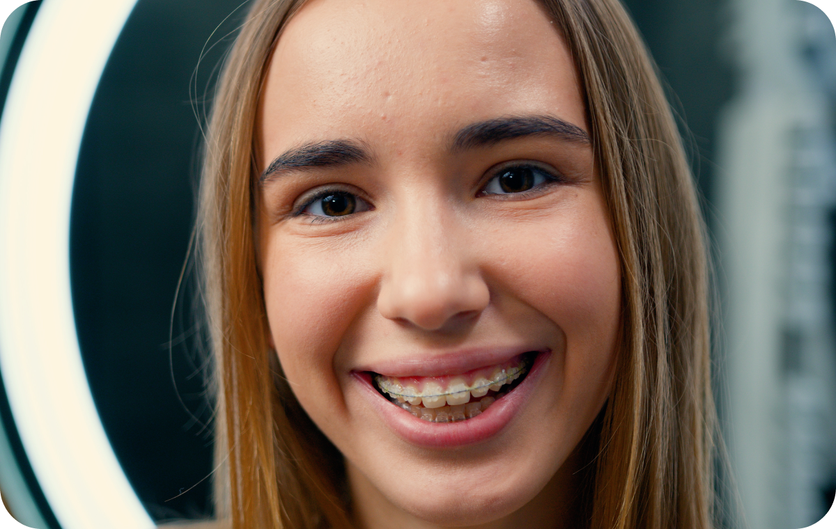 appareils dentaires mandelieu la napoule adolescent Appareils dentaires Dr Mathelin Christel | Orthodontiste Mandelieu-la-Napoule
