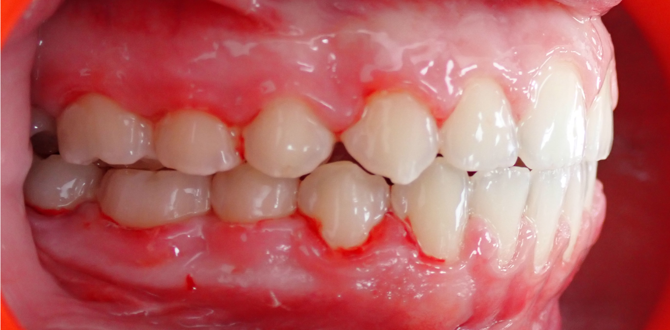 duringer_cas_chir_4_1