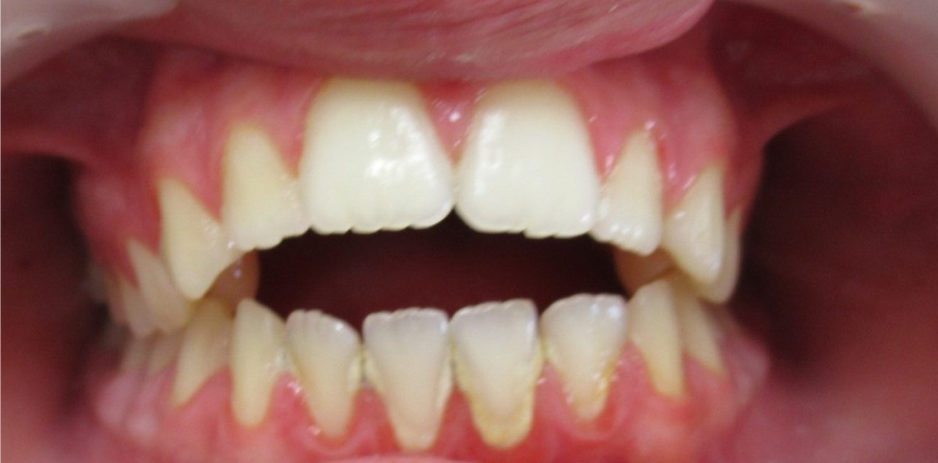 duringer_cas_chir_5_1