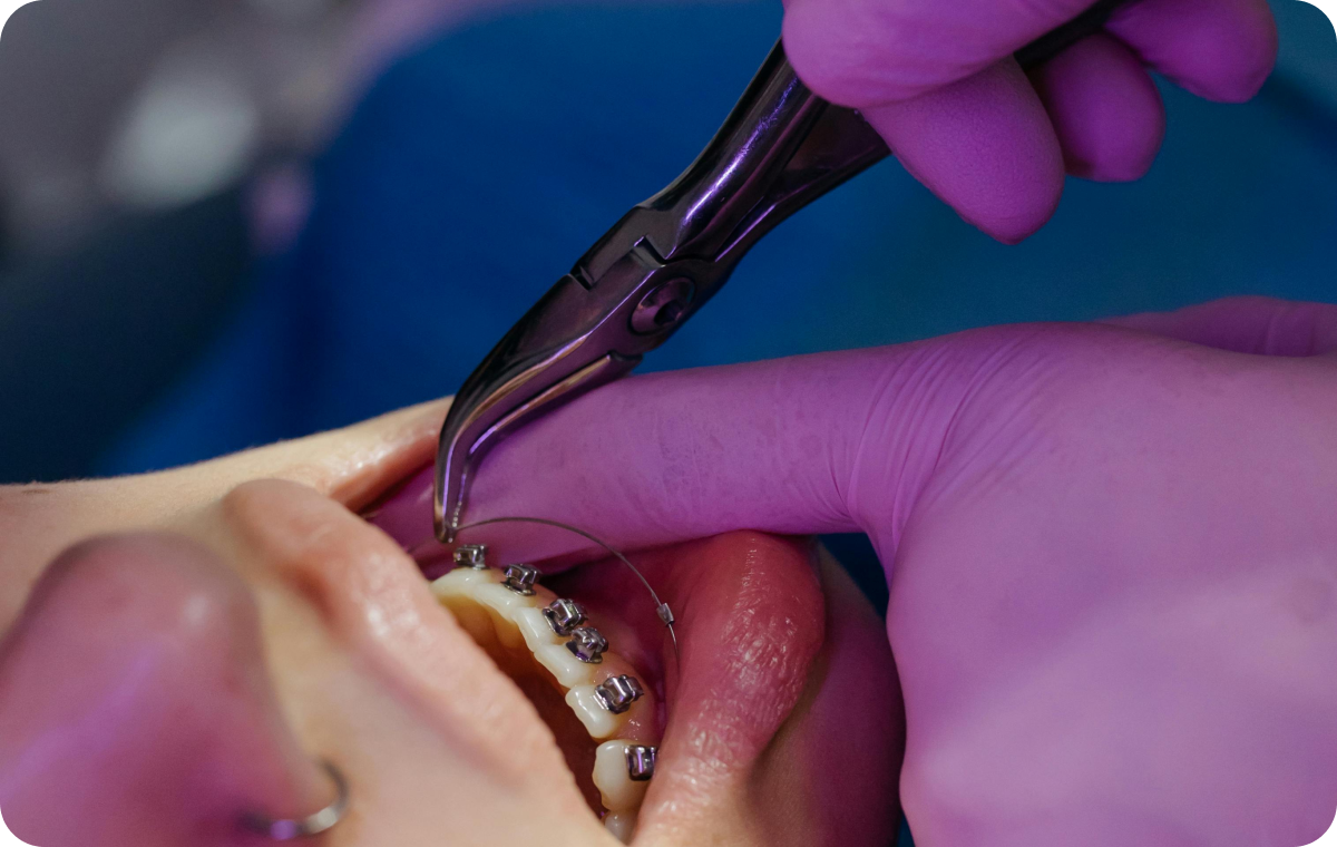 multi_bagues_adultes-5